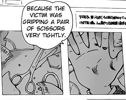 File:Scissors and bruise.jpg